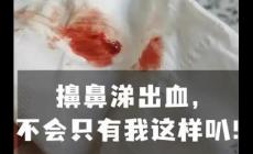 擤鼻涕鼻子经常出血是什么原因  每次擤鼻涕都有血是啥毛病